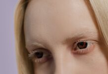 Albino Sisters Go Viral for Their Striking Beauty