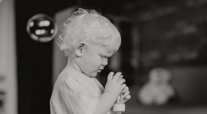 They Laughed at His White Hair – You Won’t Believe How He Looks Today