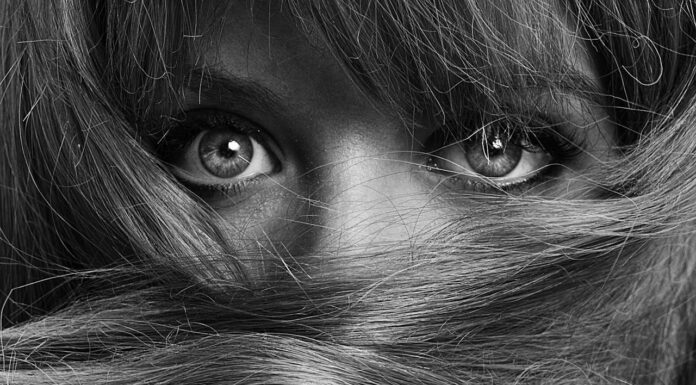 The Hairiest Girl in the World? You Won’t Believe What She Looks Like Now!