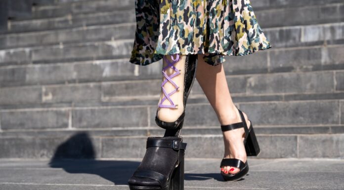 The Model Who Turned Tragedy Into Triumph