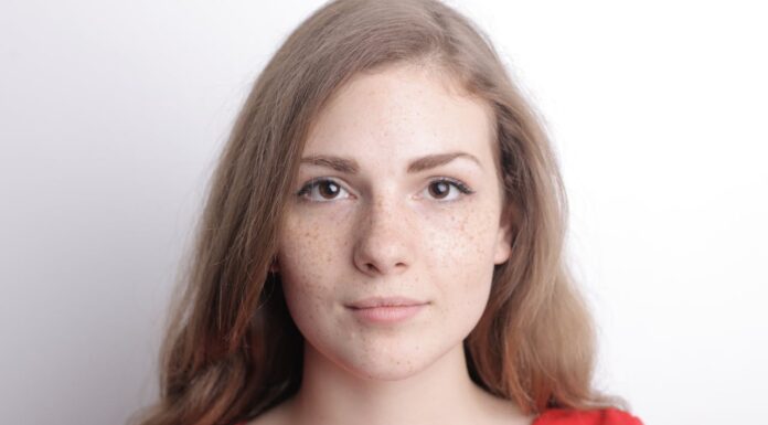 What Happens When You Use Baking Soda on Age Spots? Here’s My Story