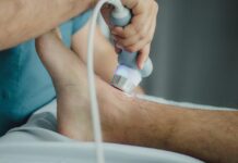 Say Goodbye to Varicose Veins with This Surprising Trick