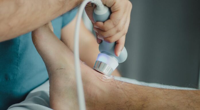 Say Goodbye to Varicose Veins with This Surprising Trick