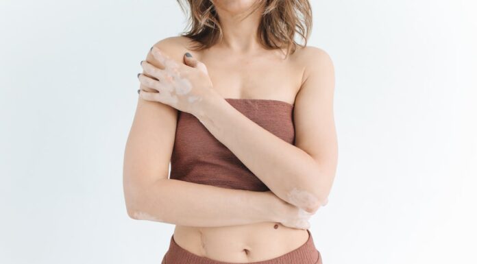 “Did You Shower With Bleach?”: How This Girl Turned Cruel Words Into Art