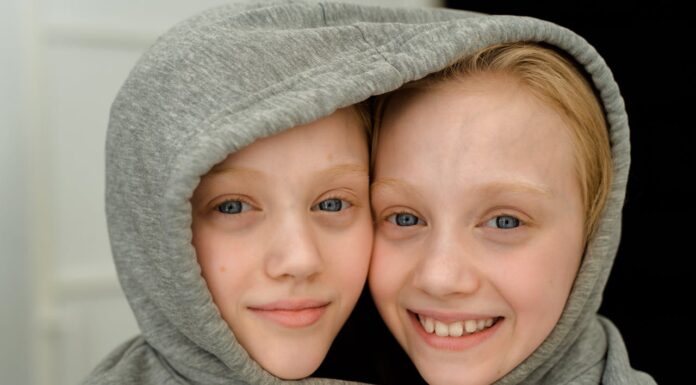 12 Years Later: How These Twins with Extraordinary Eyes Stole the Spotlight Again