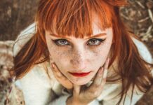 She Wanted Perfect Freckles, but Ended Up Spending $10,000 to Fix Them