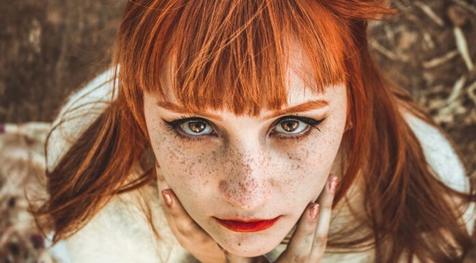 She Wanted Perfect Freckles, but Ended Up Spending $10,000 to Fix Them